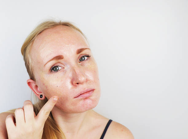 Aesthetic specialist performing an anti-aging treatment to reduce wrinkles, fine lines, and improve skin firmness for a youthful appearance.