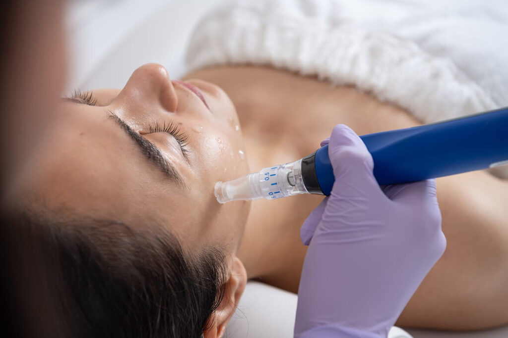 A woman undergoing laser skin rejuvenation treatment by a professional aesthetic specialist.